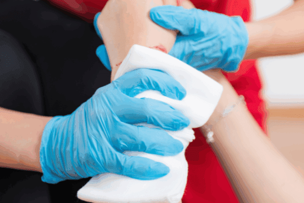 First Aid for Severe Bleeding
